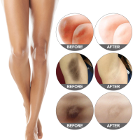 Banish Body Dark Spots Naturally: Face, Elbows, Knees, and Underarms Explained