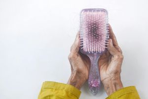 Understanding Hair Loss and Recovery: A Journey to Regaining Confidence