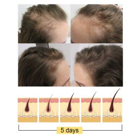 Jayswing Rice Shampoo Rice Promote Dense Hair Nourishing Repair Shampoo - 1pcs