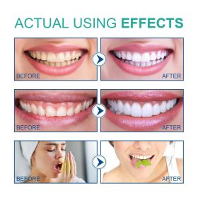 Coconut Oil Mouthwash Removes Odor, Removes Tooth Stains, Freshens Breath, Oral Care Tooth Cleanser - 1PCS
