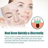 EELHOE Love Acne Patch Gentle Cleansing Acne Patch Fades Facial Acne Marks And Spots Facial Cleansing Care - 1pcs