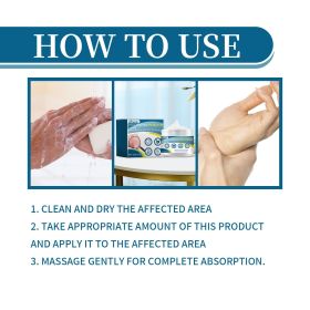 Ximonth Psoriasis Treatment Cream Repair Hand, Foot And Body Moss Redness And Itchy Skin Topical Treatment Cream - 1pcs