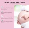 Stretch Mark Care Kit 4PCS, Pregnancy Skin Care Set for Maternity Postpar