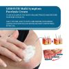 Ximonth Psoriasis Treatment Cream Repair Hand, Foot And Body Moss Redness And Itchy Skin Topical Treatment Cream - 1pcs