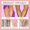 Leg Skin Care Cream - Venous Repair Cream