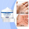 Urea & Salicylic Acid Moisturizing Hand Foot Skin Care Cream, 30g