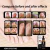 EELHOE Nail Repair Liquid Thickening, Brightening, Whitening, Repairing, Moisturizing, And Nourishing Nail Care Liquid - 1pcs