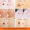 Wart Spot Nevus Remover Cream Freckle Face Wart Tag Treatment Removal Essential Oil - 20G - 20g