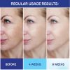 Retinol Cream for Face Collagen and Retinol Moisturizer with Hyaluronic Acid Day Night Anti Aging for Women Men - Moonrin
