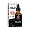 EELHOE Nail Repair Liquid Thickening, Brightening, Whitening, Repairing, Moisturizing, And Nourishing Nail Care Liquid - 1pcs