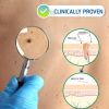 Wart Spot Nevus Remover Cream Freckle Face Wart Tag Treatment Removal Essential Oil - 20G 2PCS - 40g