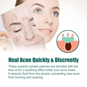 EELHOE Love Acne Patch Gentle Cleansing Acne Patch Fades Facial Acne Marks And Spots Facial Cleansing Care (Quantity: 1pc)