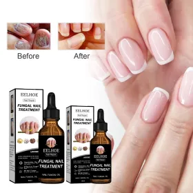 EELHOE Nail Repair Liquid Thickening, Brightening, Whitening, Repairing, Moisturizing, And Nourishing Nail Care Liquid (Quantity: 1pc)